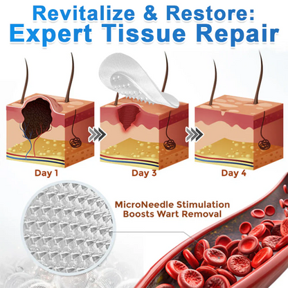 ✨𝐇𝐢𝐬𝐤𝐢𝐧® 2-in-1 Microneedle & Hydrocolloid Patch🍀 | Removes raised moles, acne, flat warts, and skin tags | Helps improve wrinkles, scars, and blemishes | Invisible patches for face and body