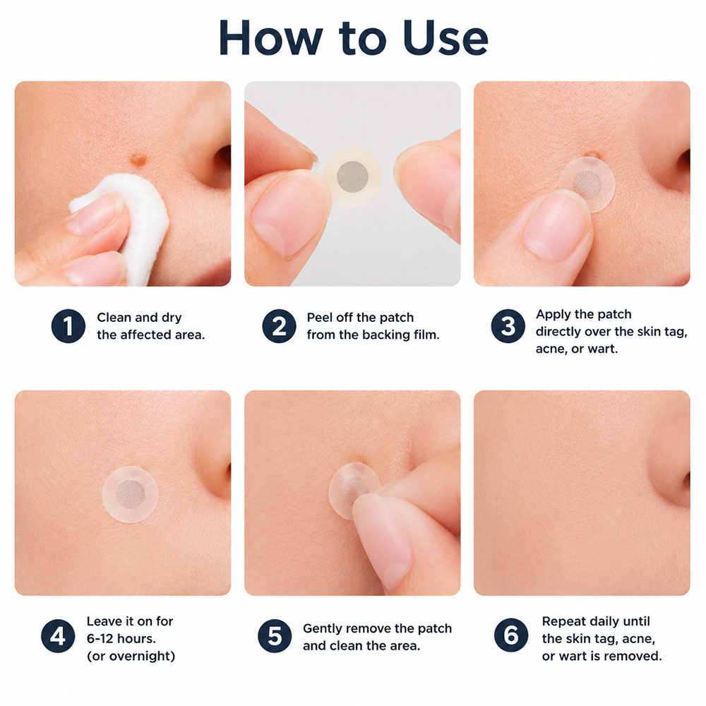 ✨𝐇𝐢𝐬𝐤𝐢𝐧® 2-in-1 Microneedle & Hydrocolloid Patch🍀 | Removes raised moles, acne, flat warts, and skin tags | Helps improve wrinkles, scars, and blemishes | Invisible patches for face and body