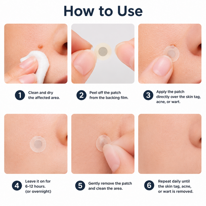 ✨𝐇𝐢𝐬𝐤𝐢𝐧® 2-in-1 Microneedle & Hydrocolloid Patch🍀 | Removes raised moles, acne, flat warts, and skin tags | Helps improve wrinkles, scars, and blemishes | Invisible patches for face and body
