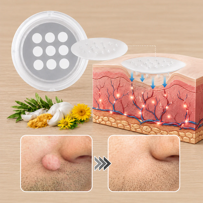 ✨𝐇𝐢𝐬𝐤𝐢𝐧® 2-in-1 Microneedle & Hydrocolloid Patch🍀 | Removes raised moles, acne, flat warts, and skin tags | Helps improve wrinkles, scars, and blemishes | Invisible patches for face and body